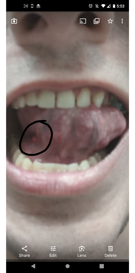 r/askdentists|Reddit .